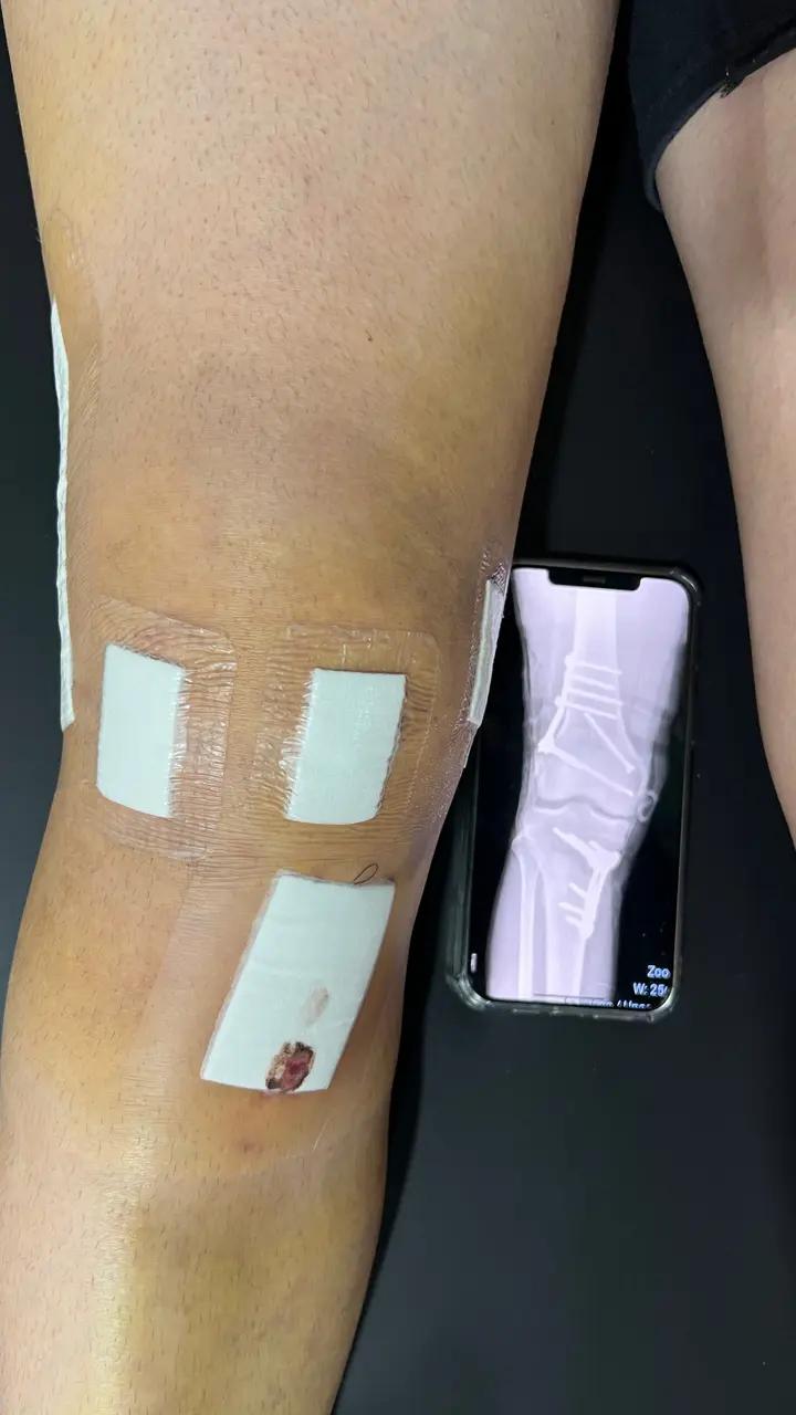ABBA Fisioterapia - fisioterapia-pre-pos-operatorio