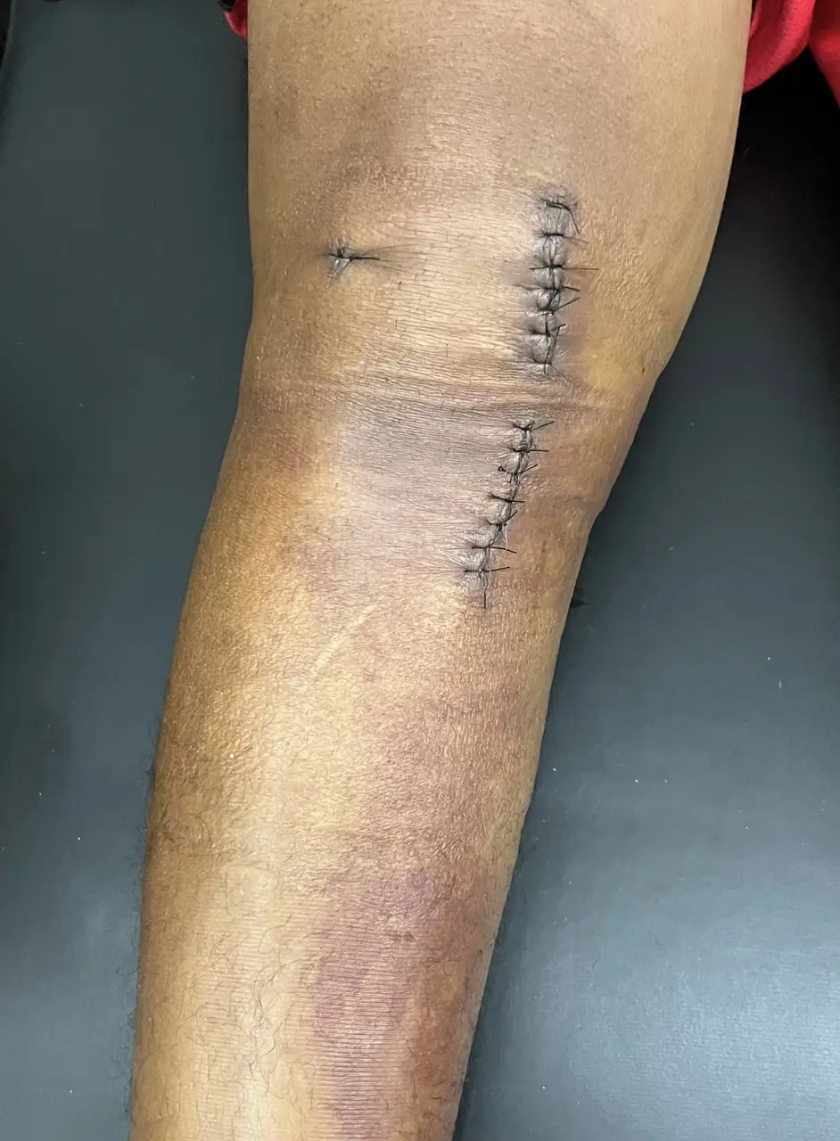 ABBA Fisioterapia - fisioterapia-pre-pos-operatorio