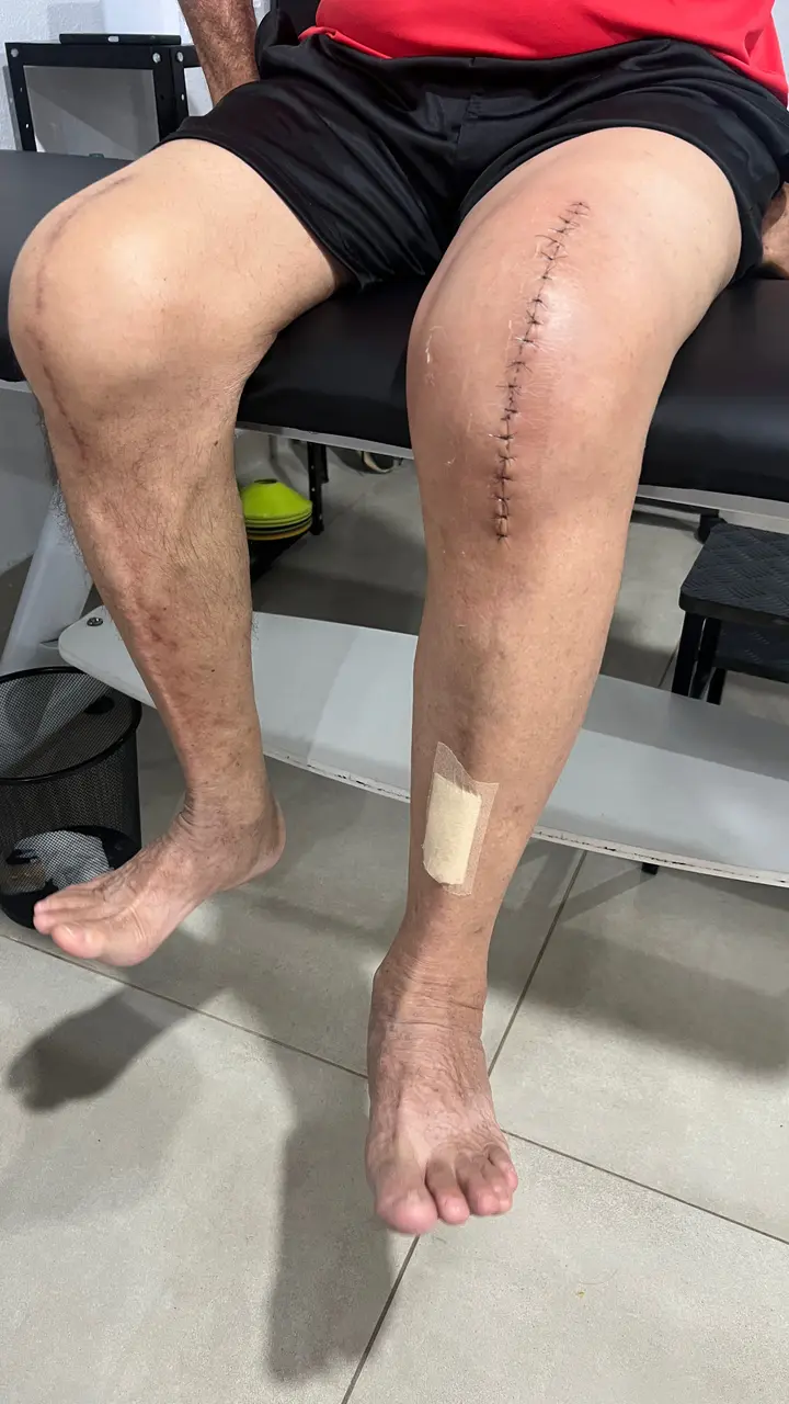 ABBA Fisioterapia - fisioterapia-pre-pos-operatorio