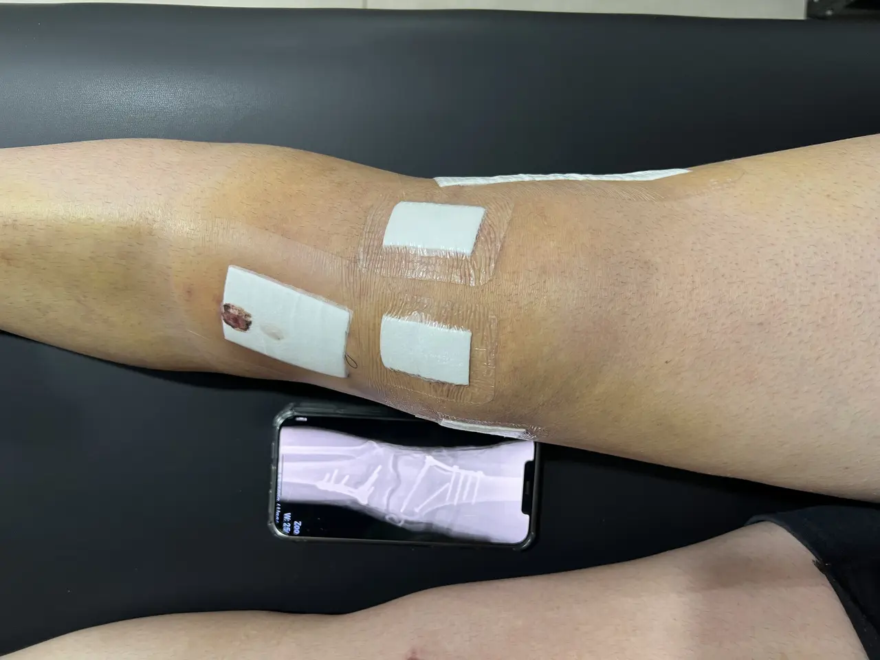 ABBA Fisioterapia - fisioterapia-pre-pos-operatorio